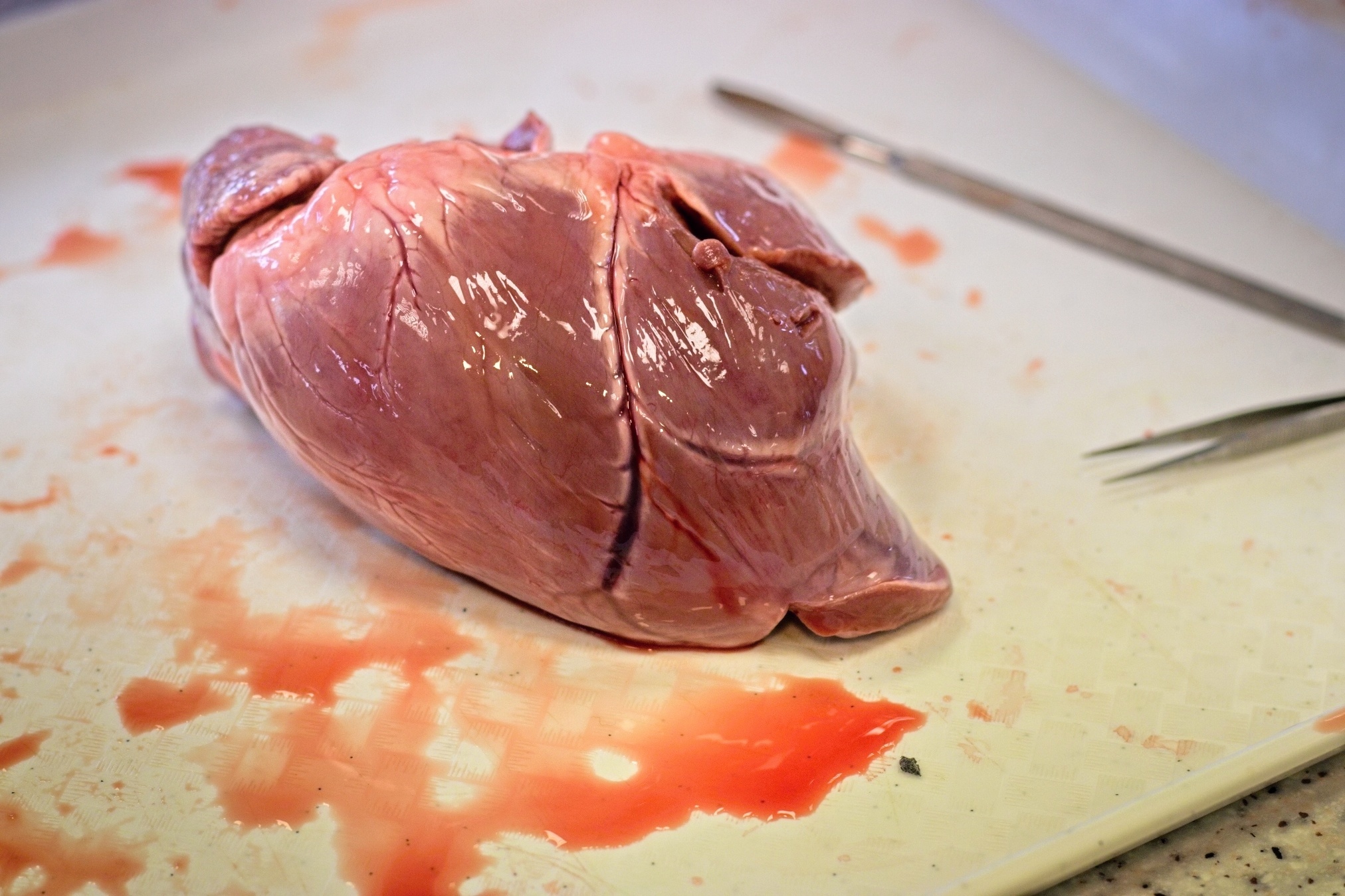 Anatomie srdce v praxi
